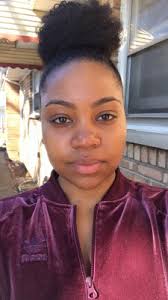 Mirena can cause serious side effects, including: Amanda S Iud Caused Hormonal Acne Here S How She Fixed It
