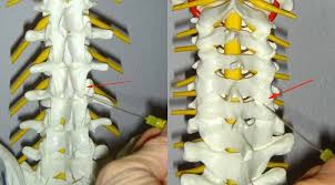 Prof Dr Christian Woiciechowsky Neurochirurgie Berlin Schmerztherapie