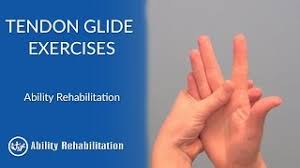 With mallet finger, the tendon on the back of the finger (not the palm side) is separated from the muscles it connects. Tendon Glide Exercises Ability Rehabilitation Youtube