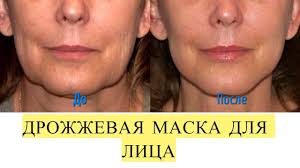 омолаживающие маски для лица в домашних условиях после 60 лет Kak Bystro Omolodit Lico Na 5 10 Let Bez Shprica I Skalpelya Youtube