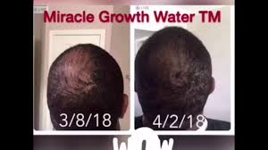 Flatironing natural hair after using my ma hair growth mask. Miracle Growth Water Customer Reviews Before And After Pictures Www Miraclegrowthwater Com Youtube