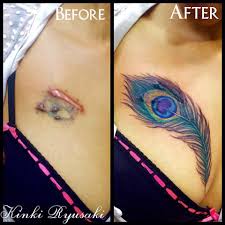 A keloid is just a scar that keeps producing more scar tissue, even after the wound has healed. Tattoo Design Reviews Posts Facebook