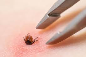 Image result for infected tick bite