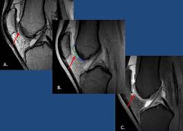 It is covered by articular cartilage that. Epos Trade