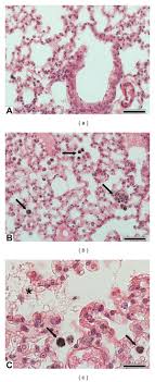 We did not find results for: Lung Histology A Sham Lung Parenchyma Showing Bronchiolar And Download Scientific Diagram