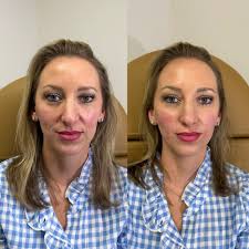 Nurse Injector Kelsey added a new...