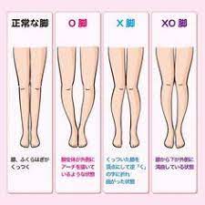 ｏ脚 ｘ脚 ｘｏ脚の違いをイラストで解説 ｏ脚治し方ガイド x脚 脚やせ ダイエット o脚