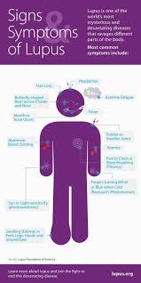 Lupus What Is It Signs And Symptoms Lupus Symptoms Lupus Facts Lupus Signs