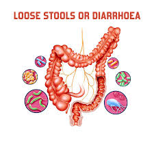 Learn more about the causes, symptoms, and treatment of diarrhea at webmd. Loose Motion Treatment Loose Motion Surgery In Coimbatore Vgm Gastro Centre