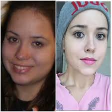 Pin On Weight Loss Before
