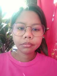 Lupus treatment options in Philippines