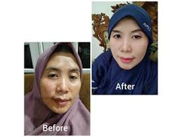 Jual Skincare Night Cream Terbaik Aj Rich Premium Jawa Timur