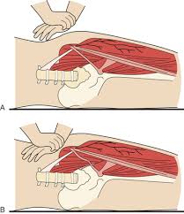 Image result for Pelvic Compression Test