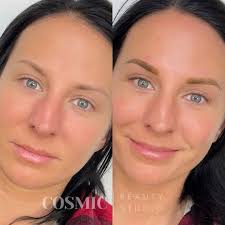 This before and after😍😍