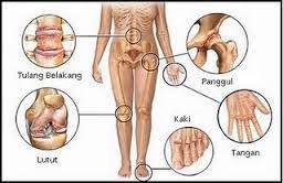 Berdasarkan kajian, penyakit batu karang lebih berisiko terjadi dalam kalangan rakyat di negara yang terletak di garisan khatulistiwa dan tropika, beriklim. Tanda Tanda Anda Mengidap Gout Yang Serius Pengedar Shaklee Alor Setar