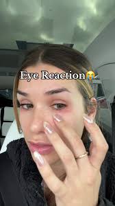 Dealing with Eye Cream Reaction: What to Do?