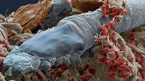 Image result for Demodex folliculorum