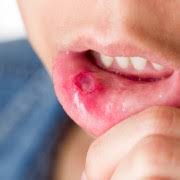 Il suffit de trouver le docteur qui a envie de vous guérir. Pourquoi Ai Je L Impression D Avoir Une Boule Dans Ma Gorge Lorsque J Avale Trucs Pratiques