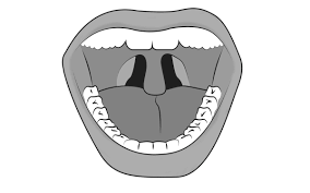 This type of swelling may come from food allergies, snoring or sleep apnea. Swollen Uvula Causes Symptoms Treatment And Remedies Hubpages