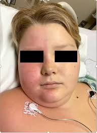 Image result for Harlequin Color Change