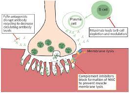 Neuromuscular Notes Next Generation Treatments For Myasthenia Gravis Practical Neurology