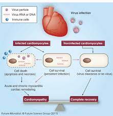 The duration of problems can vary from hours to months. Viral Myocarditis Potential Defense Mechanisms Within The Cardiomyocyte Against Virus Infection Future Microbiology