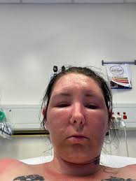 Was called out today to scan a deceased dog in a bag seen in a wooded area.  Well, all we found was 2 bags of bones, possibly of 3 animals, no feet