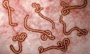 Nov 05, 2019 · ebola virus can be detected in blood after onset of symptoms. New Vaccine Design Developed To Protect Against Ebola Virus