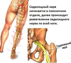 Hizhina Zdorovya Lechenie Sedalishnogo Nerva Nash Dom Mediaplatforma Mirtesen