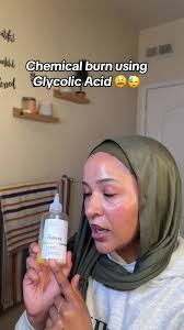 Learn from my mistakes #glycolicacid #glycolictoner #chemicalburn  #skincaretrend #theordinary #theordinaryglycolicacid @The Ordinary