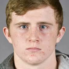 Rematch at 170 goes to Hornet