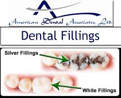 For less intrusive procedures, a topical anesthetic is likely more than enough, but for people who need more extensive procedures. Dental Fillings Are Used For Cavities Read More About The Filling Procedure The Materials Used Insurance Coverage And T Dental Fillings Dental Tooth Filling