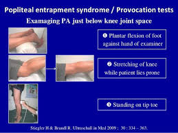 Doppler Ultrasound Of Lower Limb Arteries Ultrasound Vascular Ultrasound Ultrasound Technician