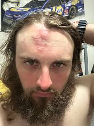 Any injuries from Testament concert?