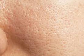 How To Minimize Pores Reduce Pore Size And Make Pores Smaller Make Pores Smaller Smaller Pores Reduce Pores