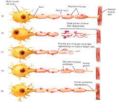 100% money back guarantee · no side effects · clinical studies backed How Can A Nerve Regenerate Step By Step Which Nerves Regenerate And Which Ones Cannot Why Quora