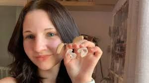 Am I the only one with hearing aids and alopecia?'