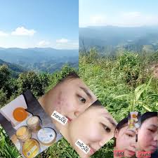 👉ມາ 100 ປາຍຊຸດສົ່ງອອກໝົດ ເຫືຼອຢູ່ແຄ່ນີ້💰💰 🤔🤔ໃຊ້ດີຂາຍປັງ ເພາະ  ຂອງມັນດີຈີງ💥💥 ✓✓ທີແລກ 20-30 ກໍ່ຢ້ານຂາຍບໍ່ໝົດ😱😱 💸💸ແຕ່ມາຕອນນີ້ຮອດ100 ...