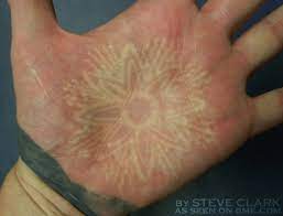 As you will see, they are a perfect choice. 13 Year Old White Ink Palm Tattoo Bme Tattoo Piercing And Body Modification News