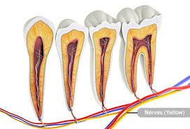 To reiterate, the most important thing is to give it time to heal. Why We Have Wisdom Teeth Surgery Pain And Treatment