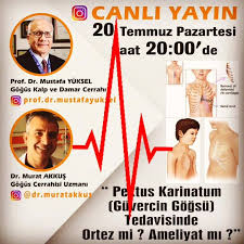 Pektus Dernegi Pektus Karinatum Guvercin Gogsu