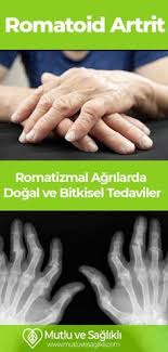 Romatoid Artrit Romatizmal Agrilarda Dogal Ve Bitkisel Tedaviler Artrit Romatoid Artrit Dogal