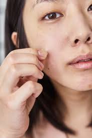 Also get some tips to prevent pimples under skin. 15 Best Pimple Patches To Clear Acne Overnight Reviews Allure