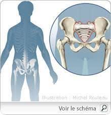 Au fil de l'évolution, l'atteinte vertébrale remonte vers les. Spondylarthrite Ankylosante Spondylite Rhumatisme Definition