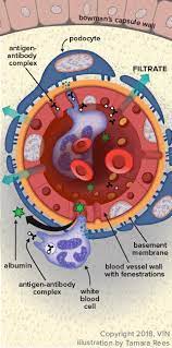Glomerulonephritis In Dogs And Cats Veterinary Partner Vin