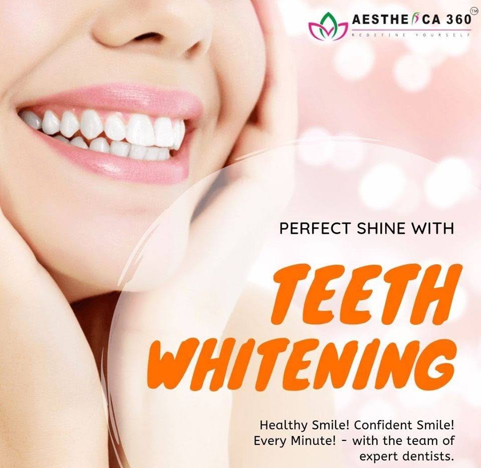 Teeth Whitening product image