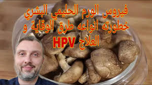 Learn about human papilloma virus (hpv) from cleveland clinic. ÙÙŠØ±ÙˆØ³ Ø§Ù„ÙˆØ±Ù… Ø§Ù„Ø­Ù„ÙŠÙ…ÙŠ Ø§Ù„Ø¨Ø´Ø±ÙŠ Ùˆ Ø³Ø±Ø·Ø§Ù† Ø¹Ù†Ù‚ Ø§Ù„Ø±Ø­Ù… Ø§Ù„ÙˆÙ‚Ø§ÙŠØ© Ùˆ Ø§Ù„Ø¹Ù„Ø§Ø¬ Hpv Youtube