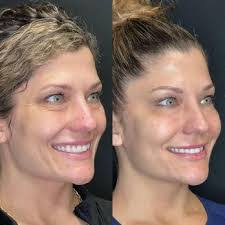 Marci Atkinson's Instagram, Twitter & Facebook