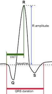 Image result for Electrocardiogram