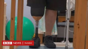 Por fortuna, su estado de salud no. Diabetes Me Amputaron La Pierna Porque No Me Atendi Mi Diabetes Tipo 2 Bbc News Mundo